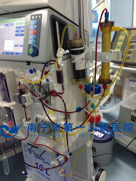 1.图为双重血浆分子吸附系统治疗模式相片.jpg