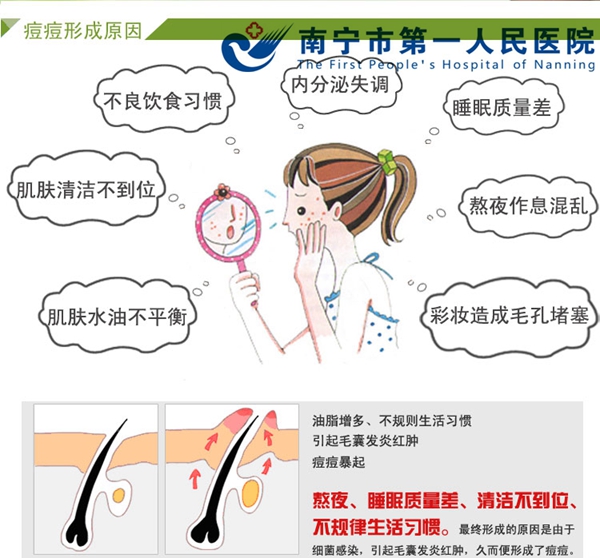 图2:痘痘形成原因.jpg