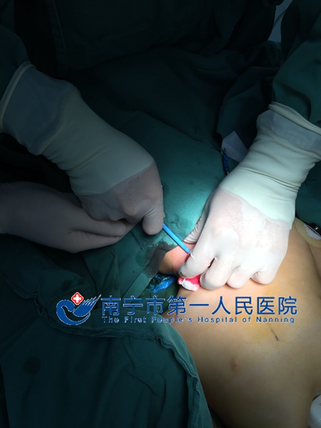 术中颈静脉穿刺 018.jpg