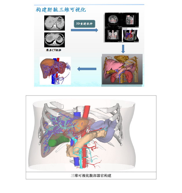 数字医学在肝胆胰腺外科的临床应用01.jpg