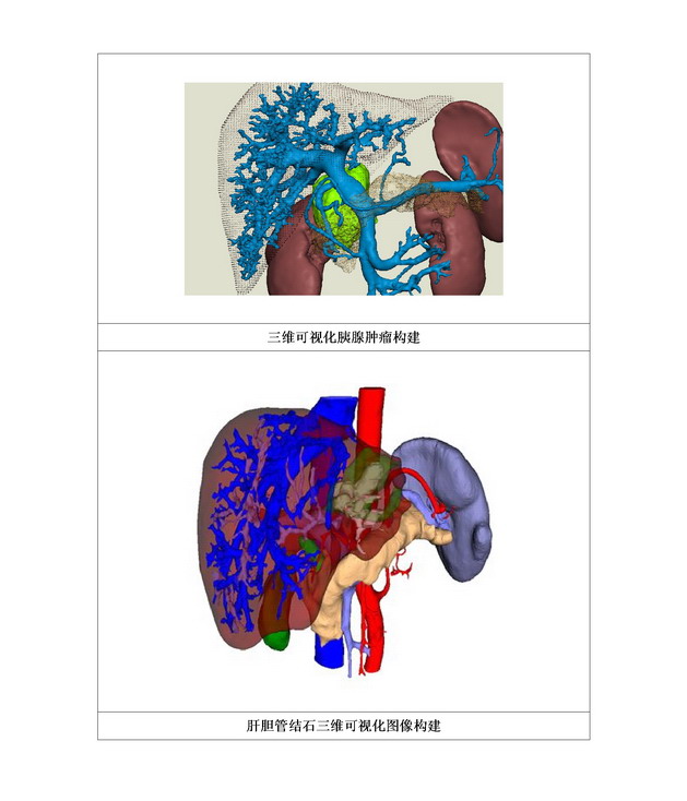 数字医学在肝胆胰腺外科的临床应用02.jpg