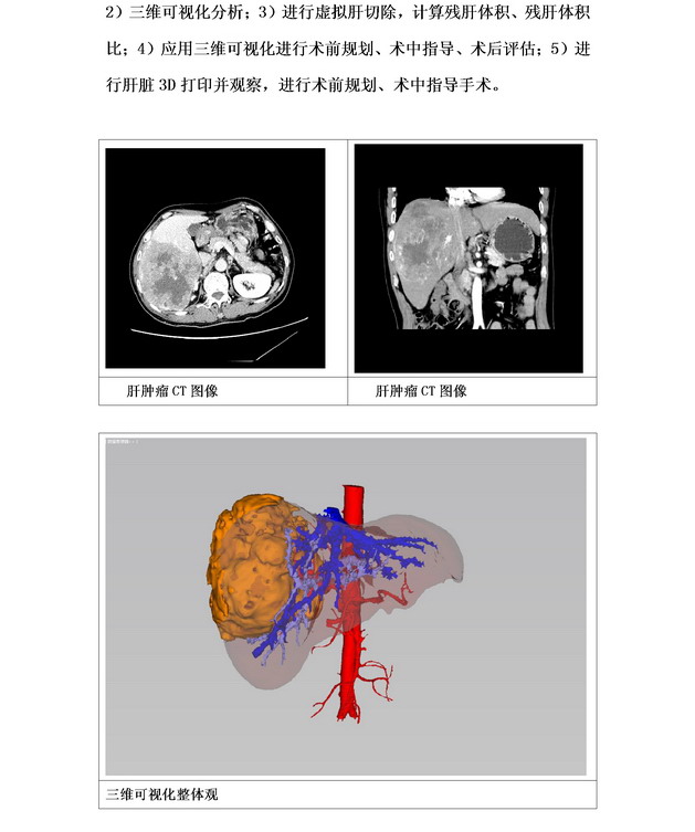 数字医学在肝胆胰腺外科的临床应用04.jpg