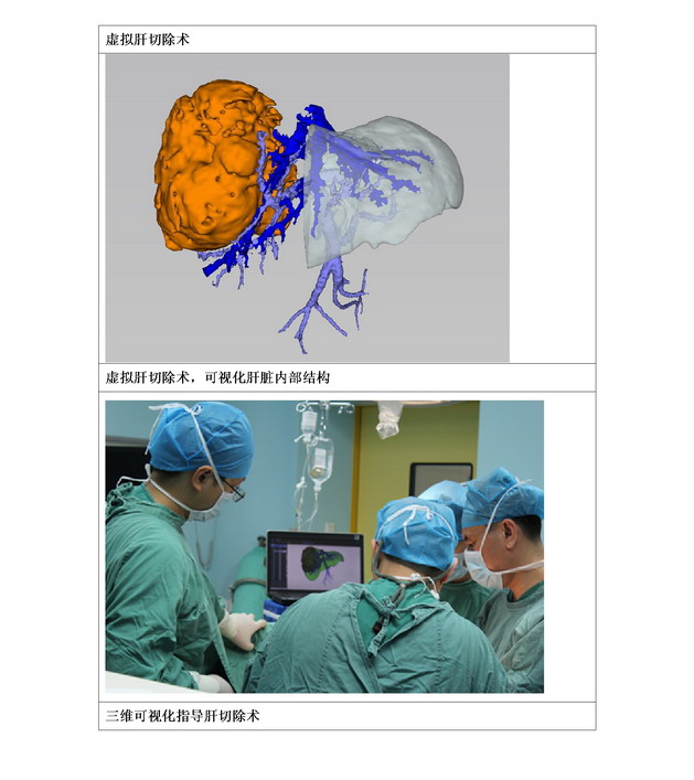 数字医学在肝胆胰腺外科的临床应用07.jpg