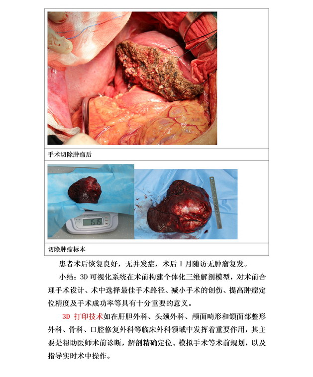 数字医学在肝胆胰腺外科的临床应用08.jpg