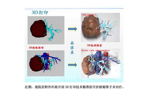 数字医学在肝胆胰腺外科的临床应用10.jpg