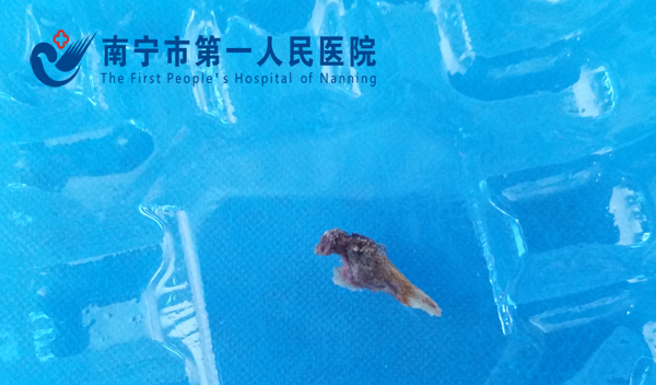 取出的鸡骨头.jpg