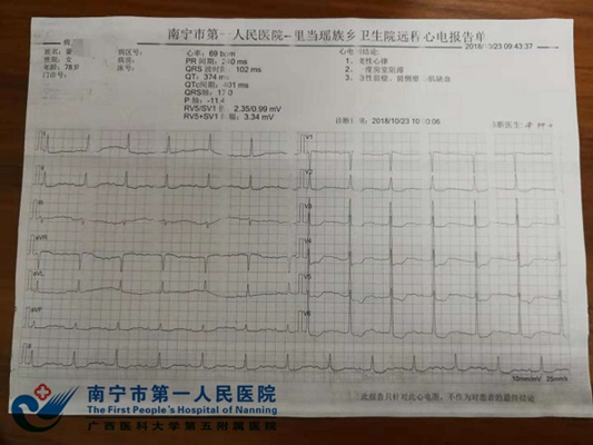 图1为患者的心电图检查结果.jpg
