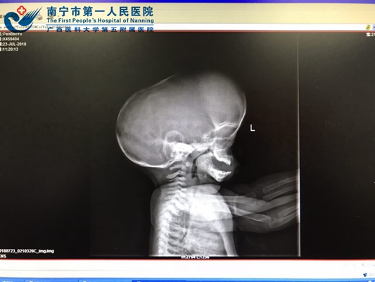 2.头颅CT.jpg
