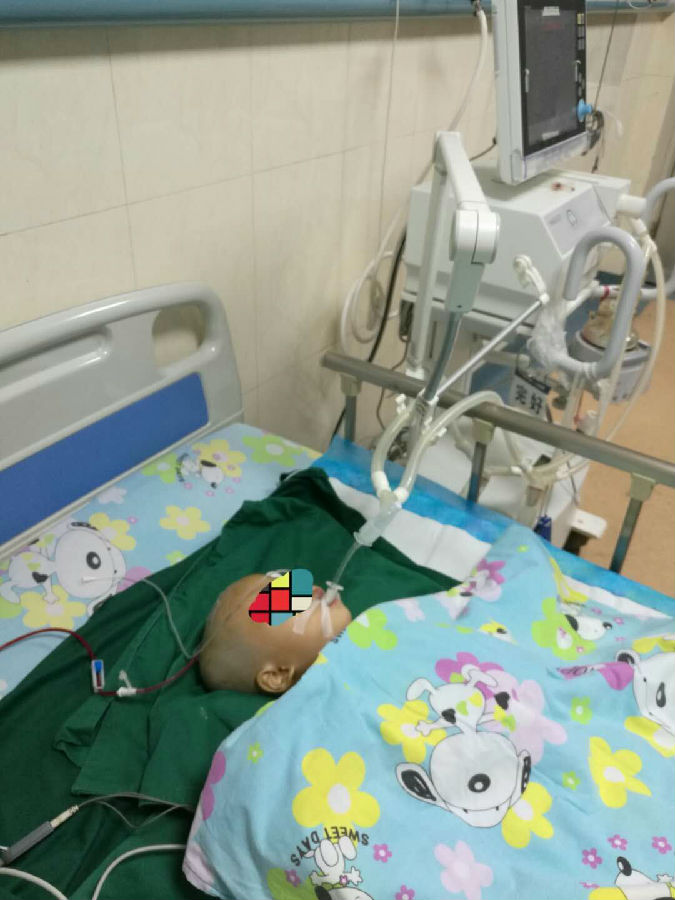 二次手术后的小路璐在儿科重症监护室里.jpg