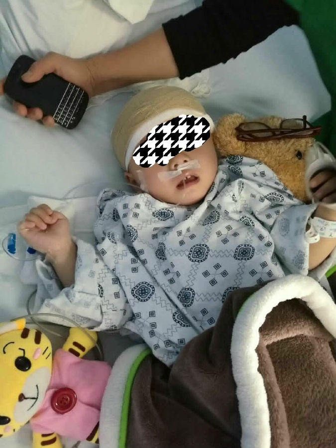 手术后苏醒的小璐璐.jpg