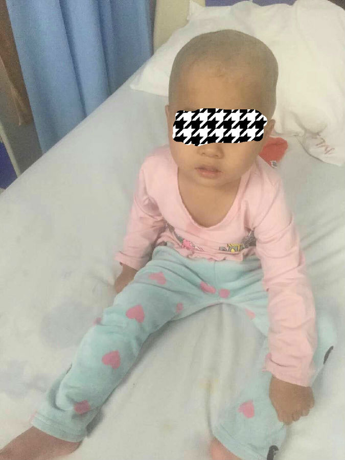小璐璐正在康复可以行走和说话了.jpg