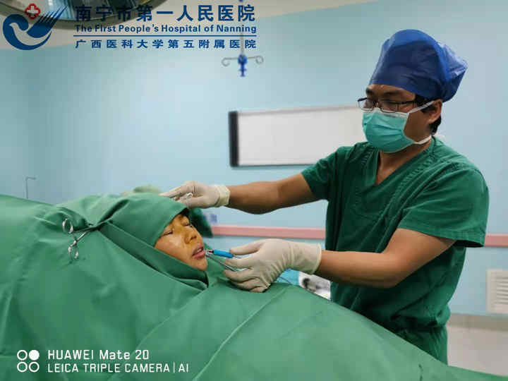 1609837692267013569.jpg 图为经皮三叉神经半月节低温等离子消融术治疗三叉神经痛_副本.jpg